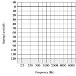 Blank Audiogram Template Download 2 TEMPLATES EXAMPLE TEMPLATES