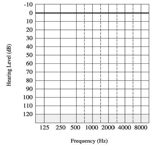 Blank Audiogram Template Download 2 TEMPLATES EXAMPLE TEMPLATES 