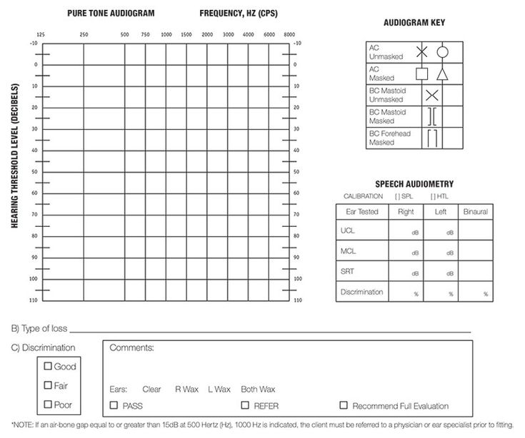 Blank Audiogram Template Download 4 TEMPLATES EXAMPLE TEMPLATES 
