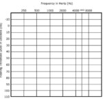 Blank Audiogram Template Download Free Download In Blank Audiogram